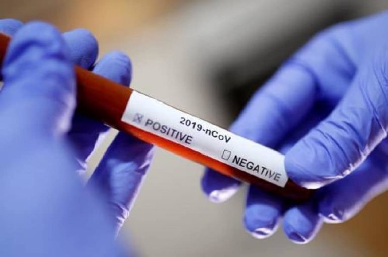 Coronavirus : L’Australie enregistre 5988 cas d’infection et 50 cas de décès