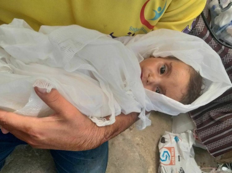 Mort douloureuse d’un enfant dans les camps des réfugiés syriens en raison de malnutrition
